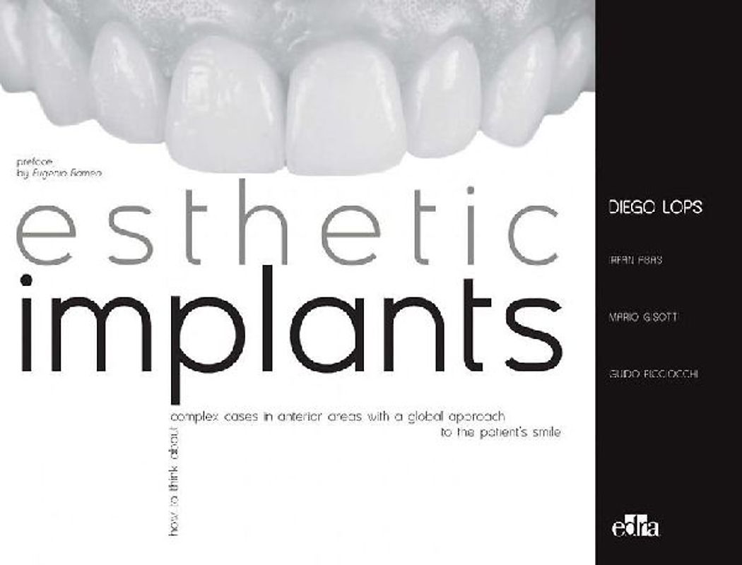 Esthetic Implants How to Think about Complex Cases in Anterior Areas with a Global Approach to the Patient Smile (2 Books)