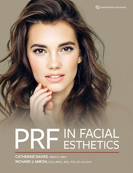 PRF in Facial Esthetics