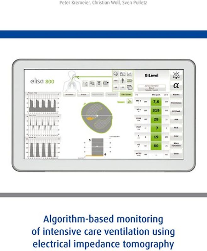 Algorithm-based monitoring of intensive care ventilation using electrical impedance tomography