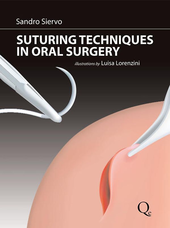 Suturing Techniques in Oral Surgery