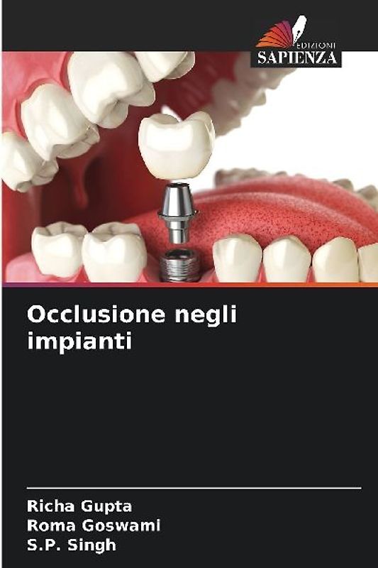 Occlusione negli impianti