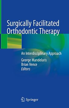 Surgically Facilitated Orthodontic Therapy
