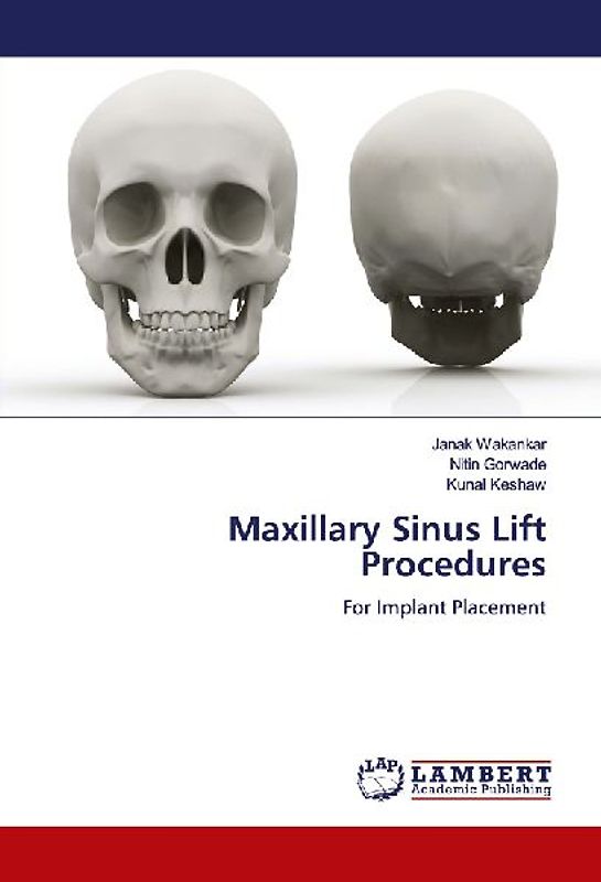 Maxillary Sinus Lift Procedures
