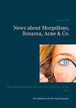 News about Morgellons, Rosazea, Acne & Co.. My thoughts about old and new diseases of the skin