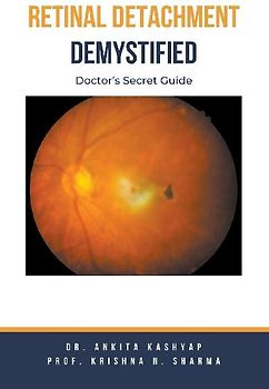 Retinal Detachment Demystified