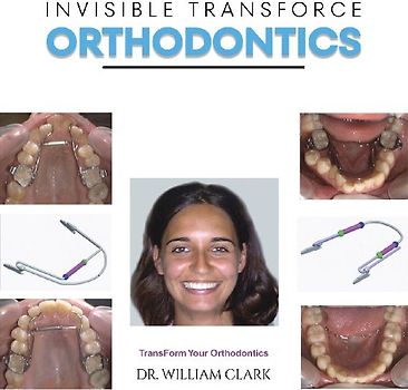Invisible TransForce Orthodontics