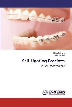 Self Ligating Brackets