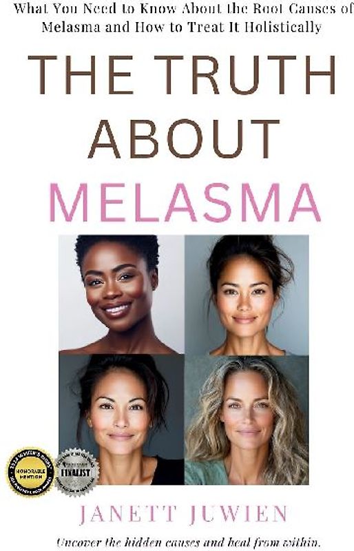 The Truth About Melasma