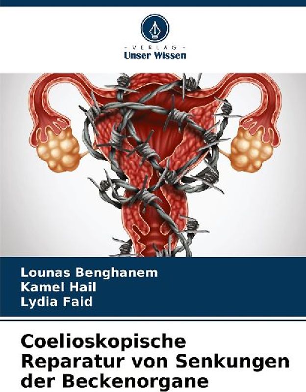 Coelioskopische Reparatur von Senkungen der Beckenorgane