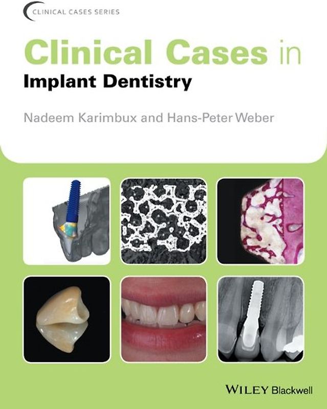 Clinical Cases in Implant Dentistry