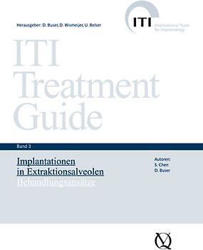 Implantationen in Extraktionsalveolen