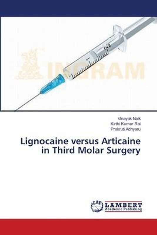 Lignocaine versus Articaine in Third Molar Surgery