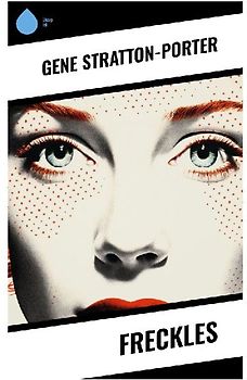 Freckles