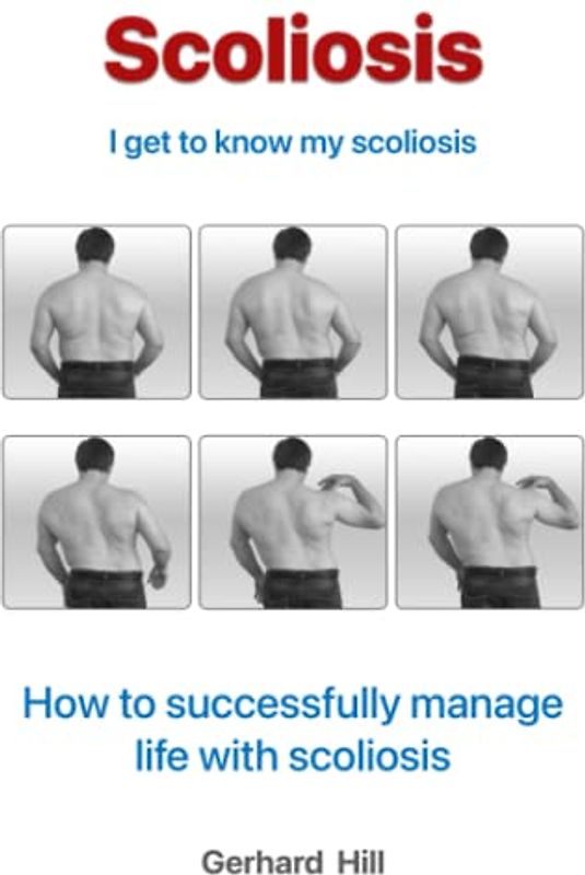 Scoliosis: I'm getting to know my scoliosis