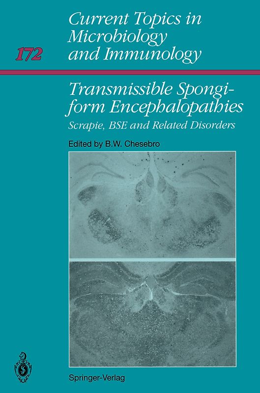 Transmissible Spongiform Encephalopathies: