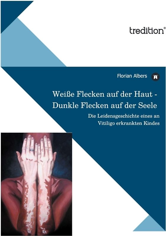 Weiße Flecken auf der Haut - Dunkle Flecken auf der Seele