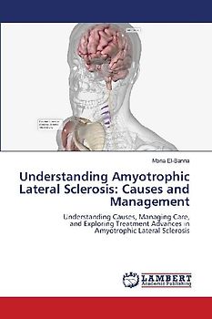 Understanding Amyotrophic Lateral Sclerosis: Causes and Management