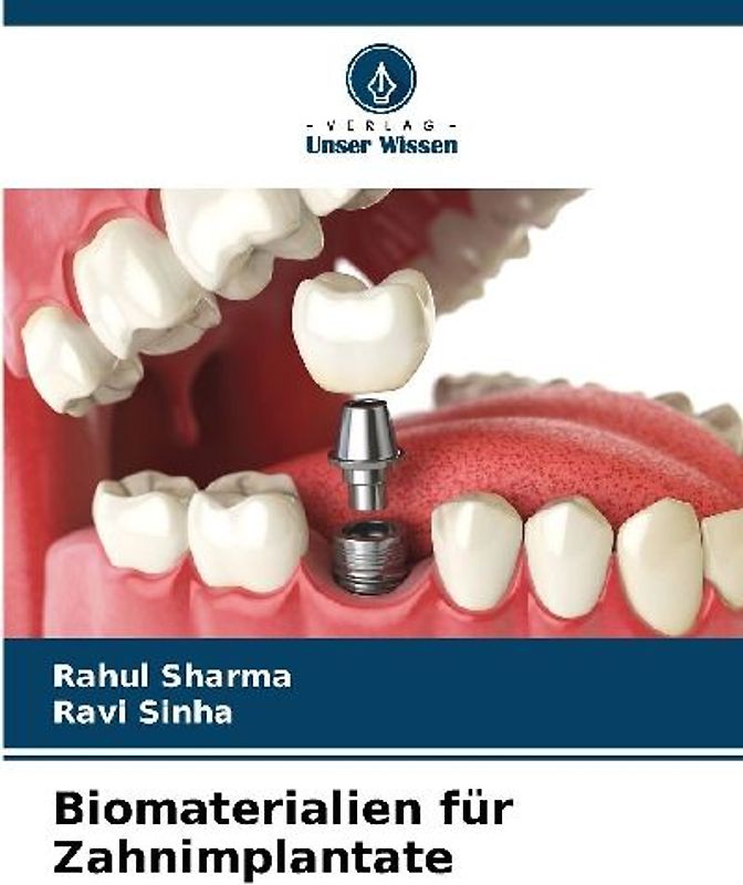 Biomaterialien für Zahnimplantate