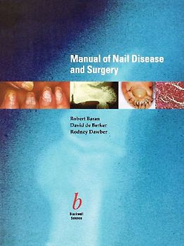 Manual of Nail Disease and Surgery