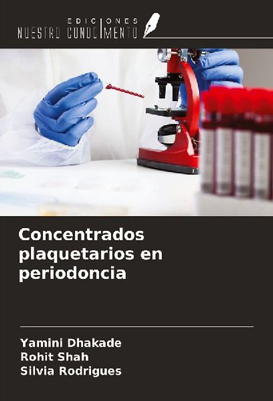 Concentrados plaquetarios en periodoncia