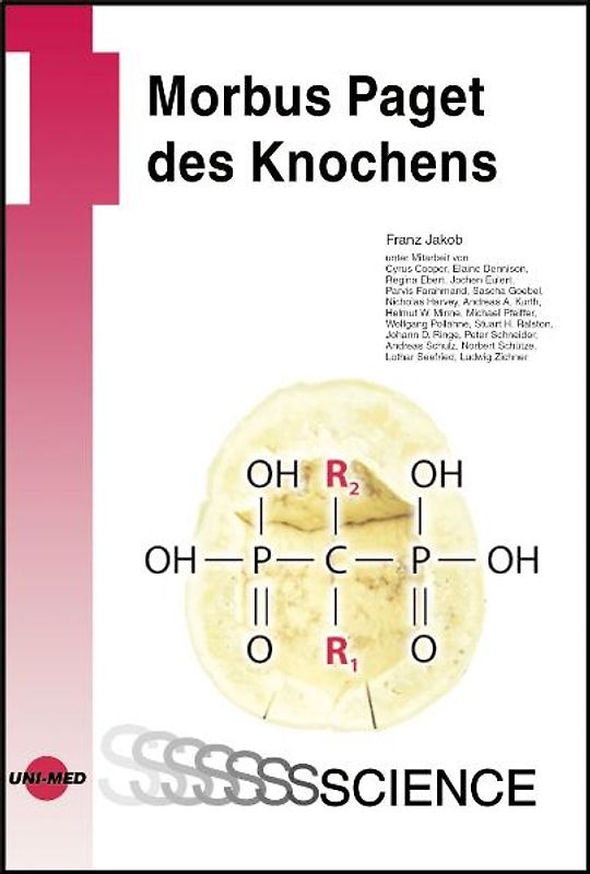 Morbus Paget des Knochens