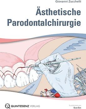 Ästhetische Parodontalchirurgie