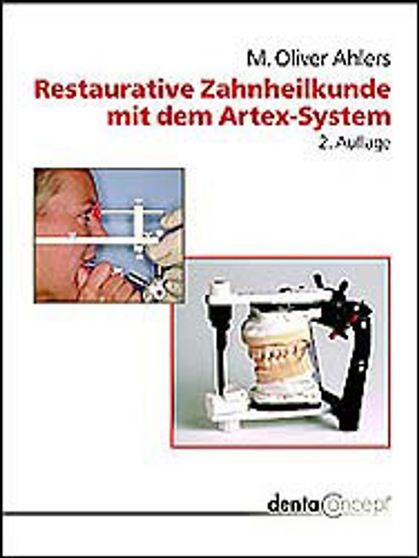 Restaurative Zahnheilkunde mit dem Artex-System