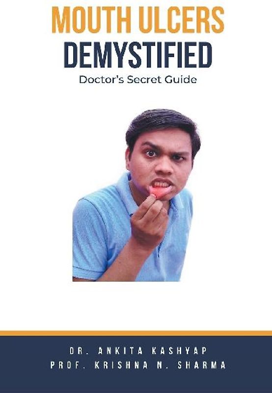 Mouth Ulcers Demystified