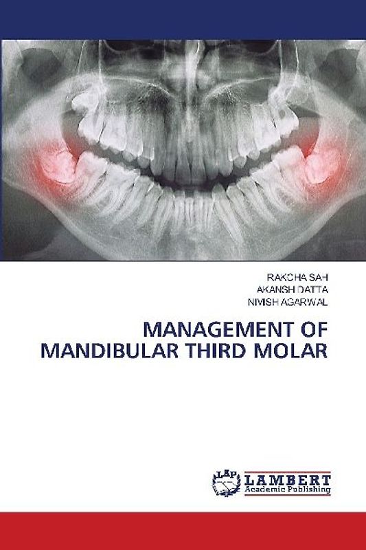 MANAGEMENT OF MANDIBULAR THIRD MOLAR