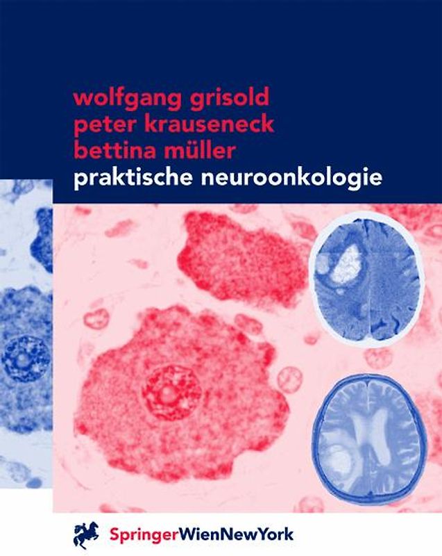 Praktische Neuroonkologie