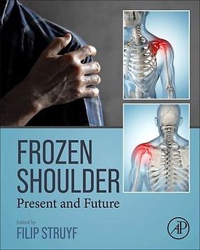 Frozen Shoulder