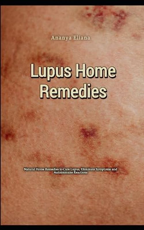 Lupus Home Remedies: Natural Home Remedies to Cure Lupus, Eliminate Symptoms and Autoimmune Reactions