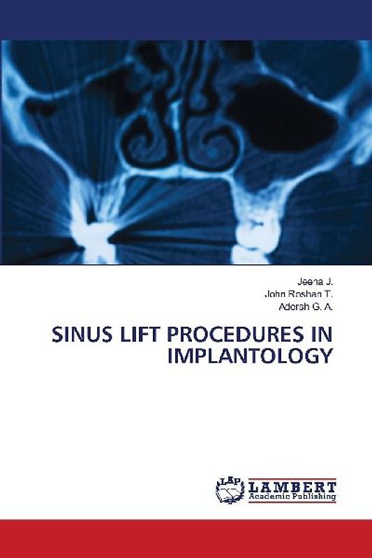SINUS LIFT PROCEDURES IN IMPLANTOLOGY