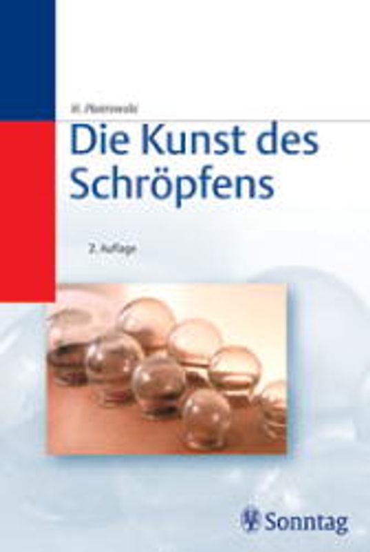 Die Kunst des Schröpfens