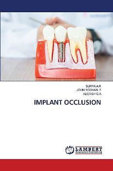 IMPLANT OCCLUSION