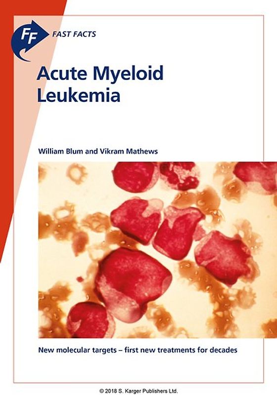 Fast Facts: Acute Myeloid Leukemia