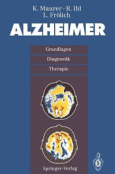 Alzheimer