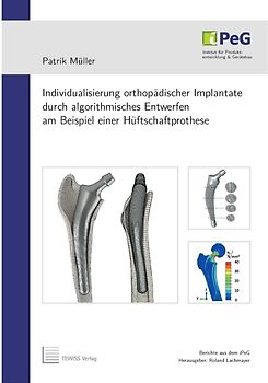 Individualisierung orthopädischer Implantate durch algorithmisches Entwerfen am Beispiel einer Hüftschaftprothese
