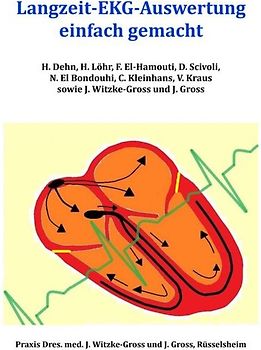 Langzeit-EKG-Auswertung einfach gemacht
