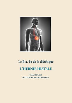 Le B.a.-ba diététique de l'hernie hiatale