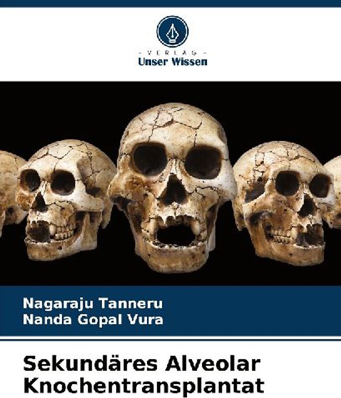 Sekundäres Alveolar Knochentransplantat