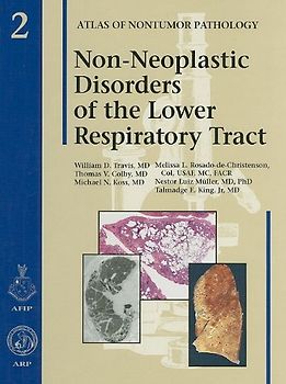 Atlas of Nontumor Pathology: Non-Neoplastic Disorders of the Lower Respiratory Tract - William D. Travis [Hardcover]