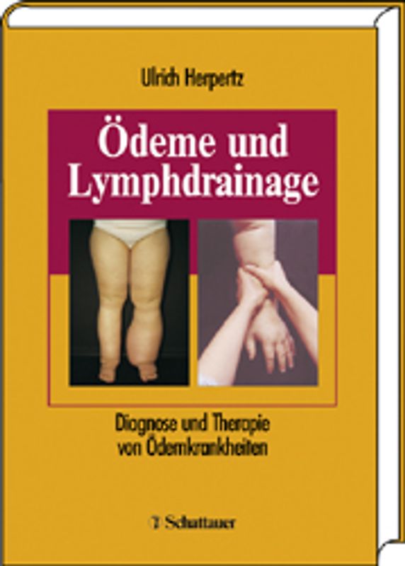 Ödeme und Lymphdrainage