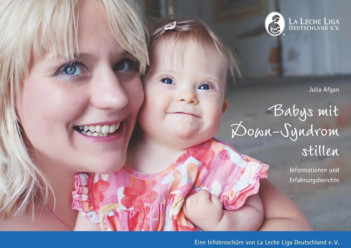 Babys mit Down-Syndrom stillen