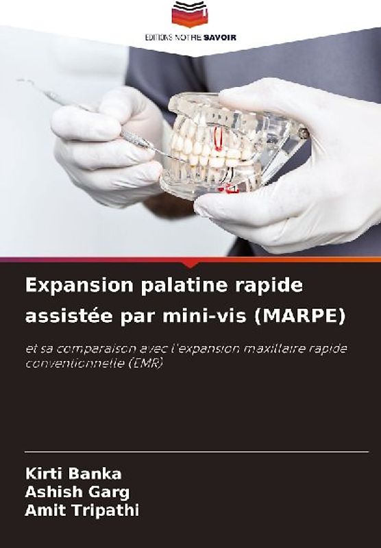 Expansion palatine rapide assistée par mini-vis (MARPE)