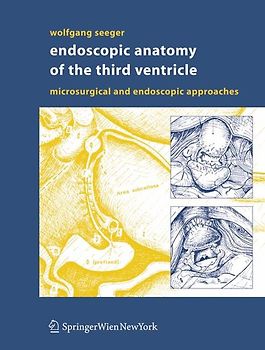 Endoscopic Anatomy of the Third Ventricle