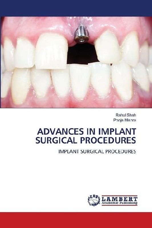ADVANCES IN IMPLANT SURGICAL PROCEDURES