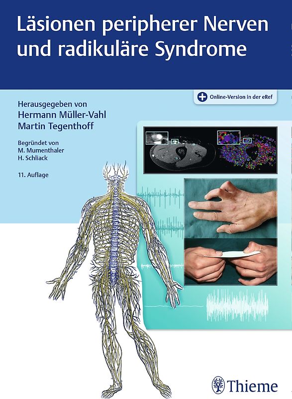 Läsionen peripherer Nerven und radikuläre Syndrome