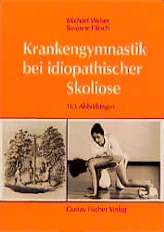 Krankengymnastik bei idiopathischer Skoliose. Befundaufnahme, Prinzip und Behandlung nach Martha Scharll