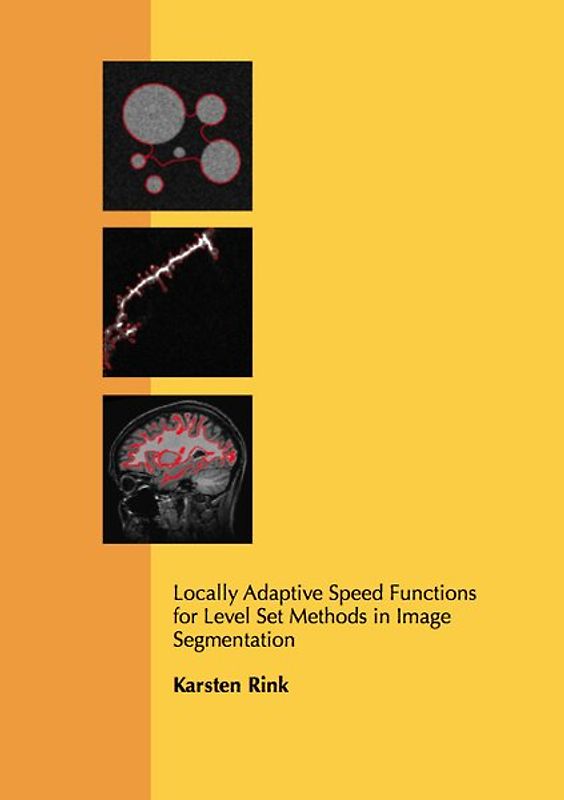 Locally Adaptive Speed Functions for Level Set Methods in Image Segmentation